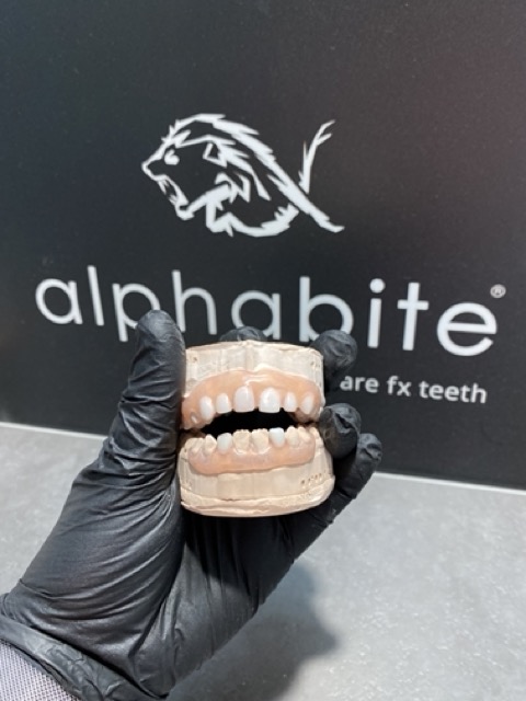 Kunstzahnprothese zum Verdecken von Zahnlücken und mit integriertem Wackelzahn
